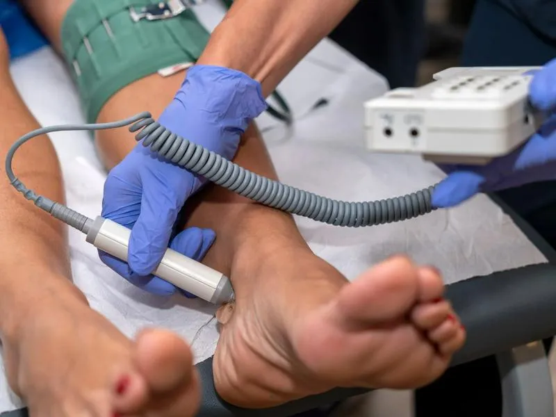 Leczenie choroby tętnic obwodowych